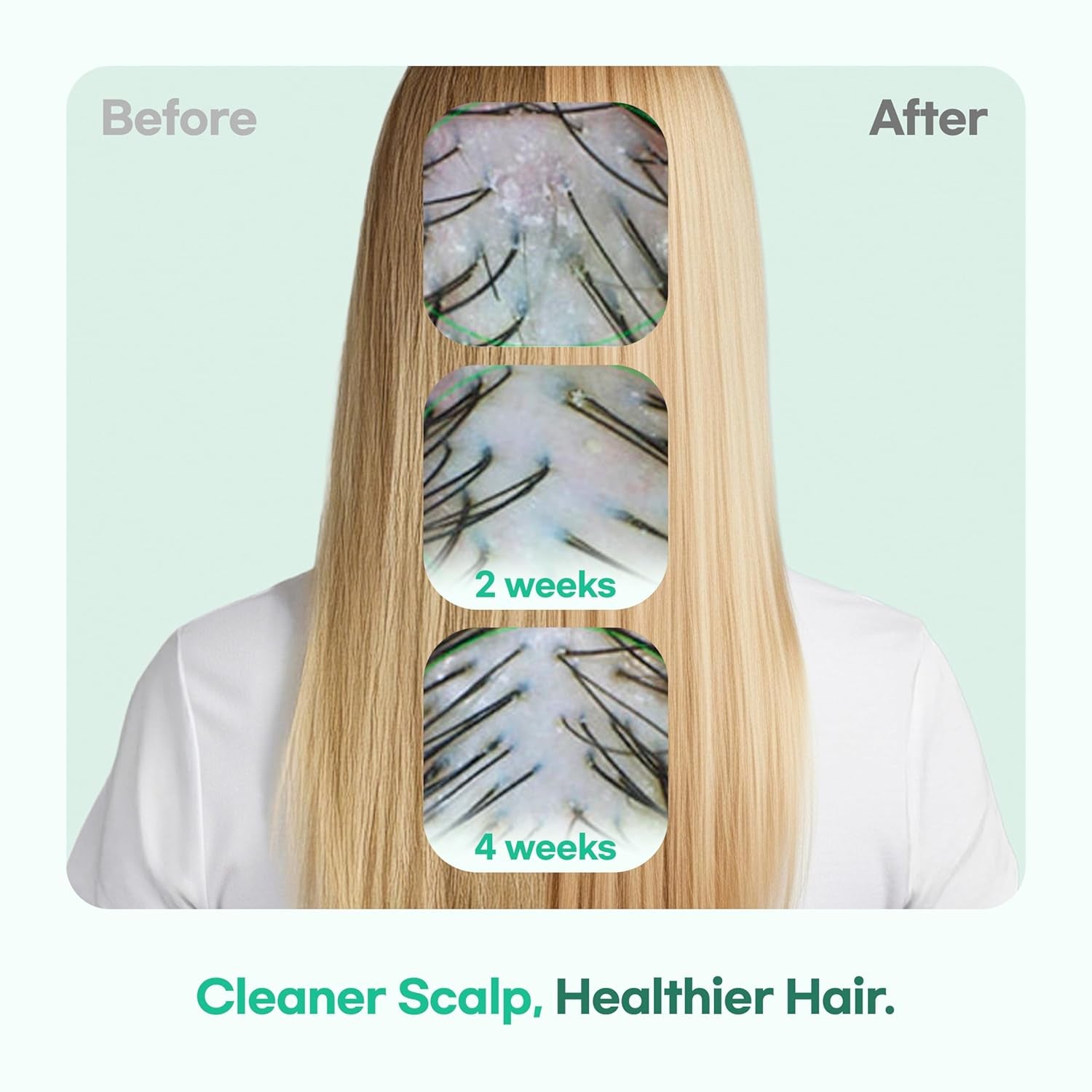 TS GD Shampoo for Teens | Korean Anti-Dandruff for Oily & Itchy Scalp | Fruity Allergy-Free Scent | Sulfate-Free Gentle Hair Care (14.1 Oz) (GD Shampoo for Girl)